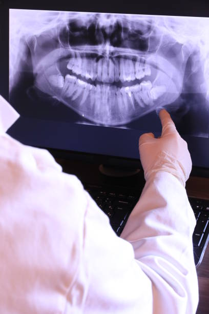 Best Knocked-Out Tooth (Avulsed Tooth) Treatment in Tornillo, TX
